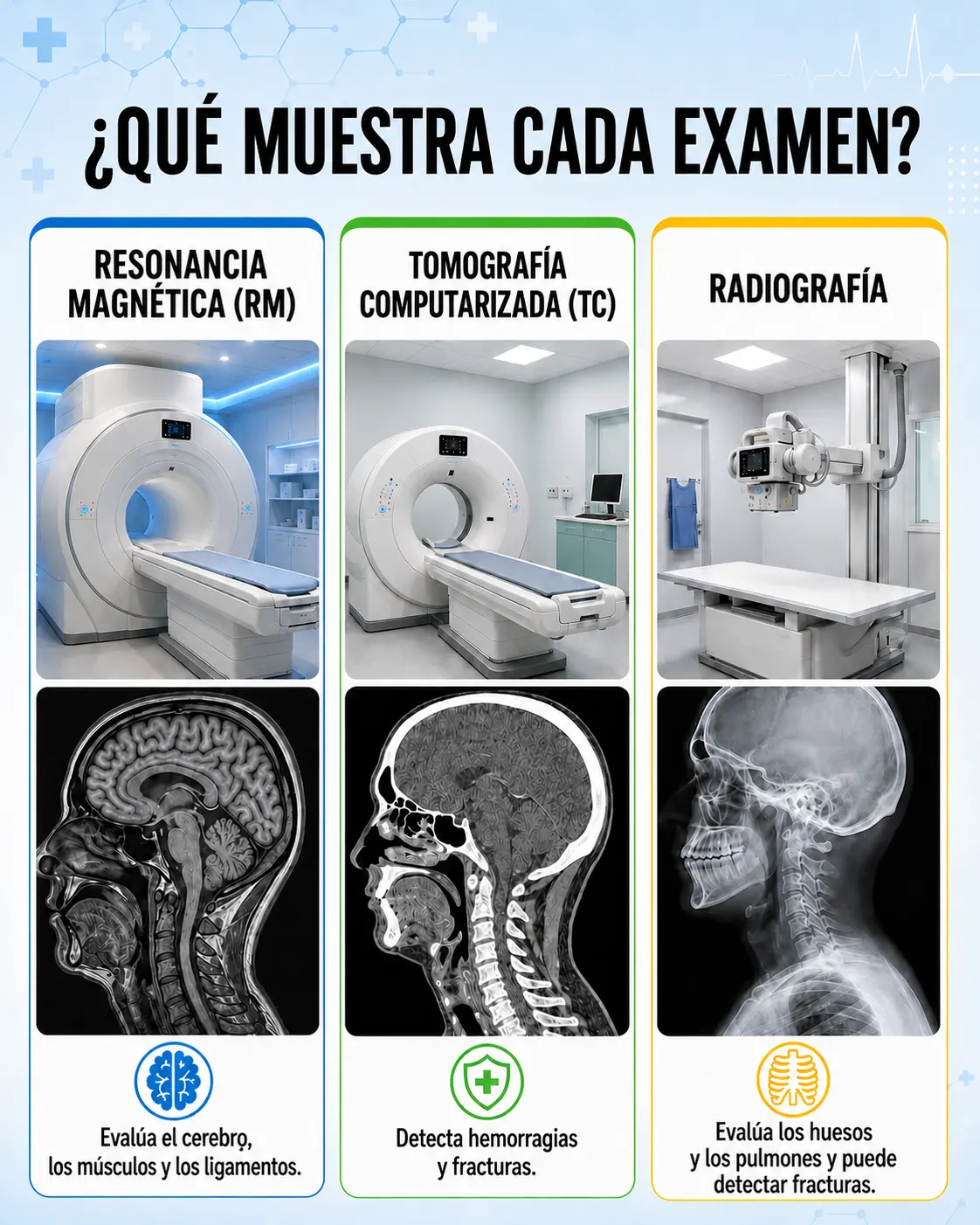 Dispositivo para tomografía en espiral CT