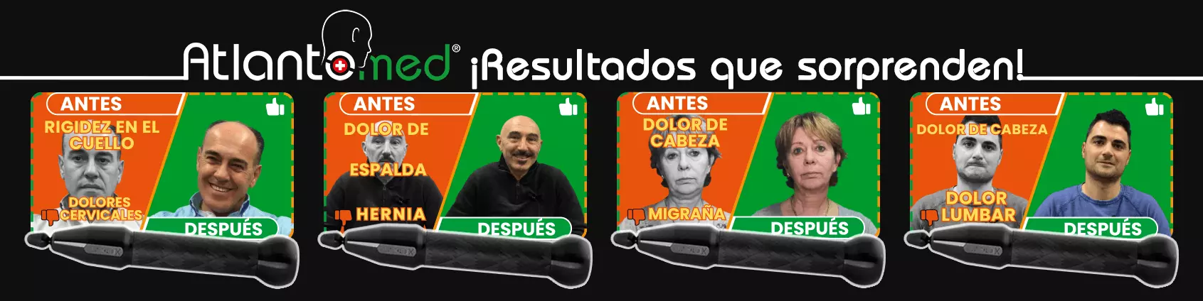 Corrección del Atlas AtlantoMed YouTube ES