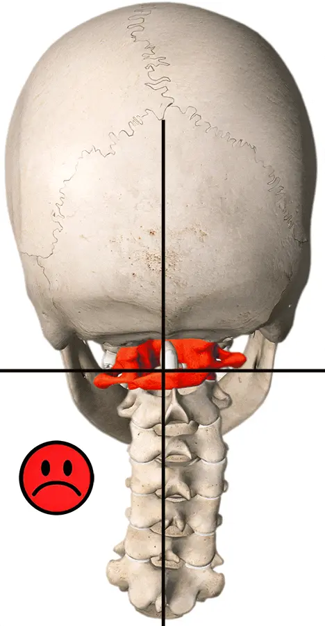 Corrección del Atlas