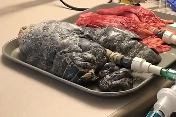 Pulmones ahumados