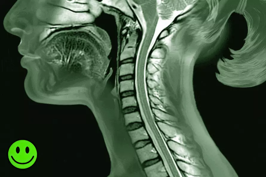 Síntomas de verticalización de la columna cervical
