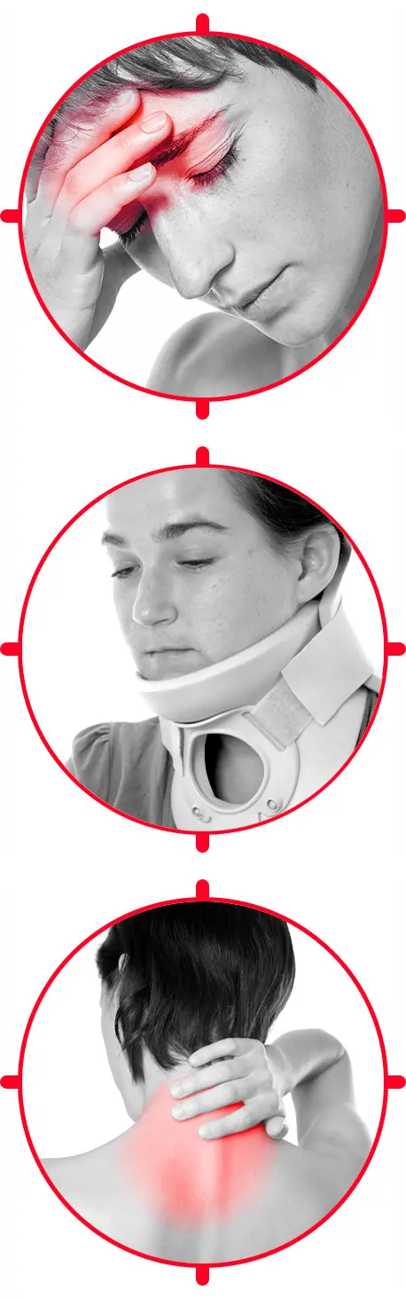 Síntomas después de un latigazo cervical